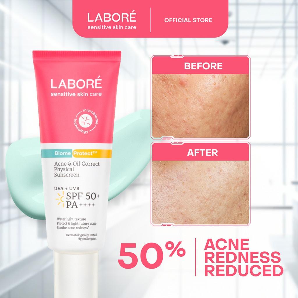 Acne & Oil Correct Physical Sunscreen