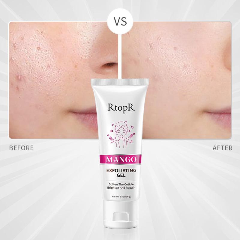 Mango Exfoliating Gel