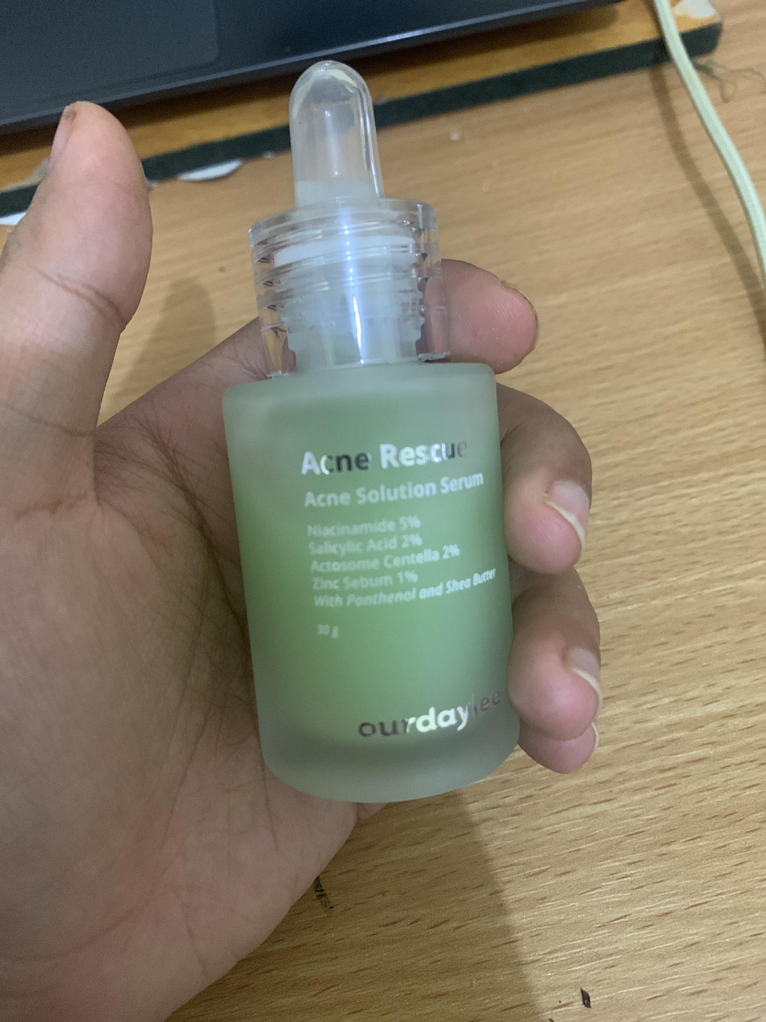 Acne Care Serum