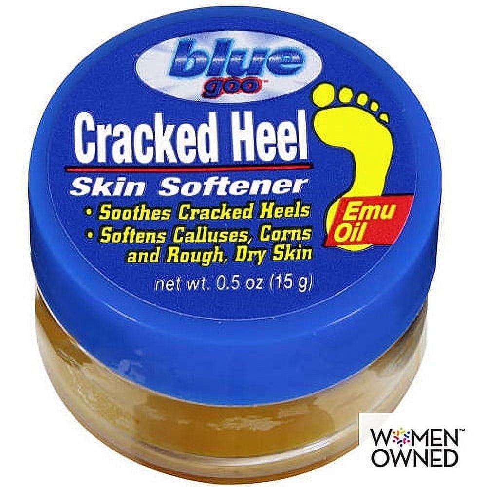 Cracked Heels