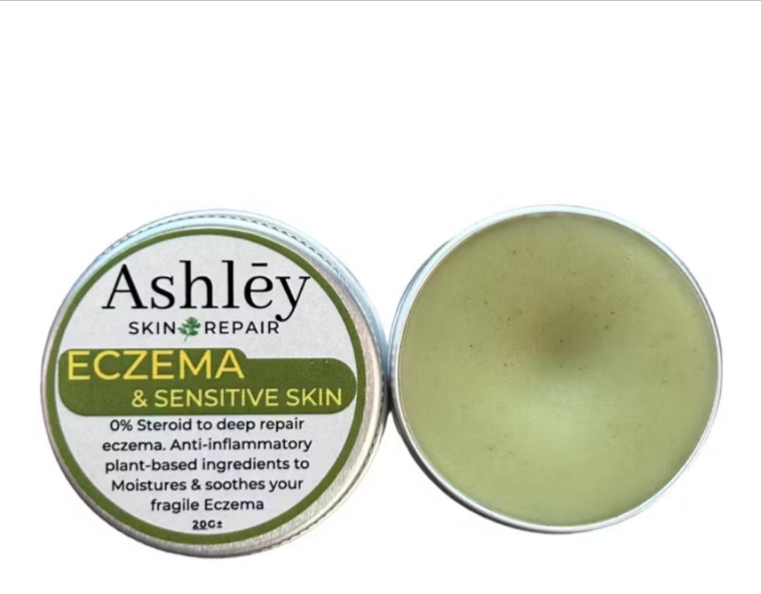 Ashley Eczema And Sensitive Skin Balm